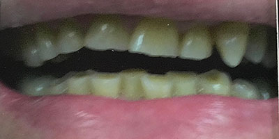 sg-400x200-before-8