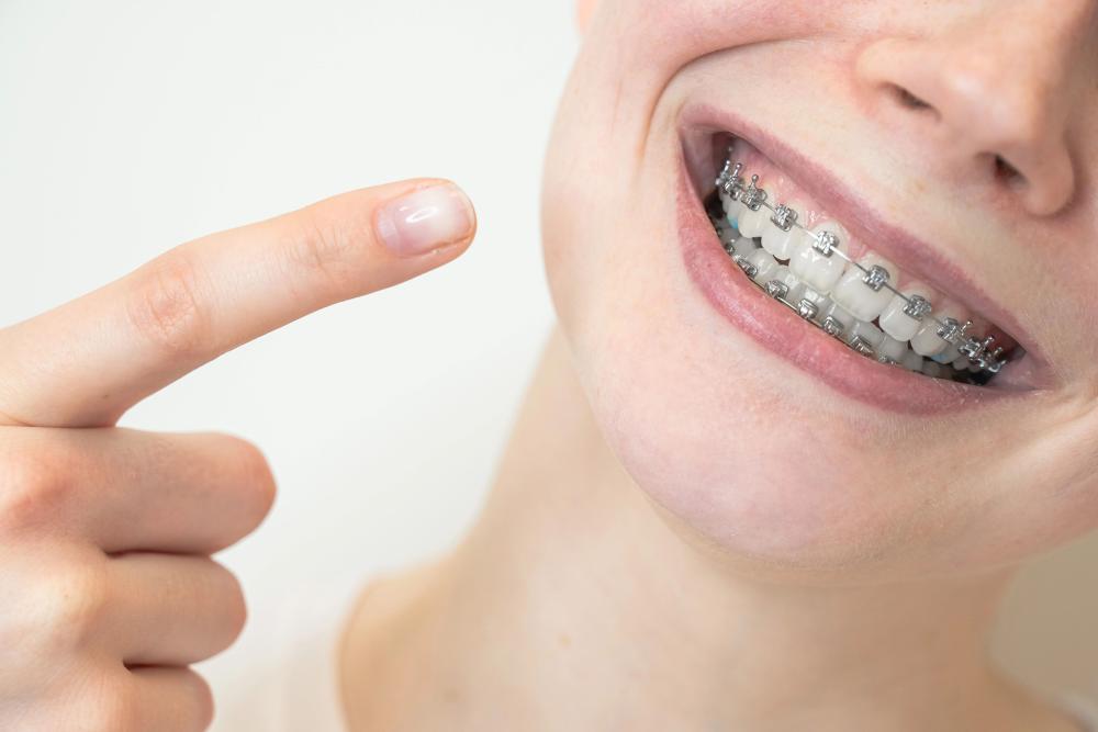 Braces Vs. Invisalign: How To Decide What’s Best For Your Teeth