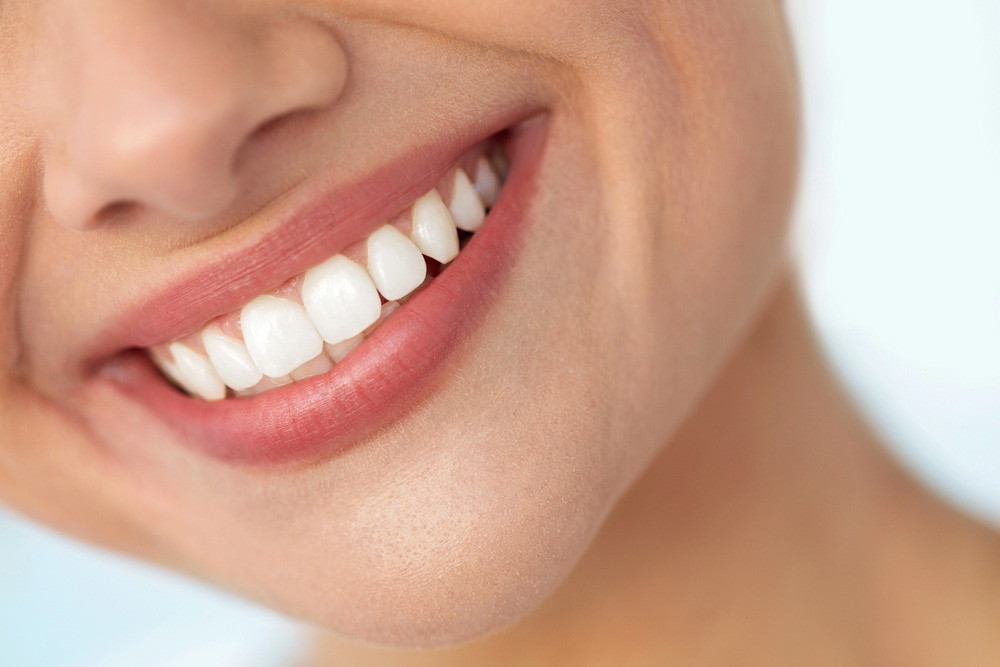 What Is Cosmetic Dental Bonding? A Simple Smile Solution
