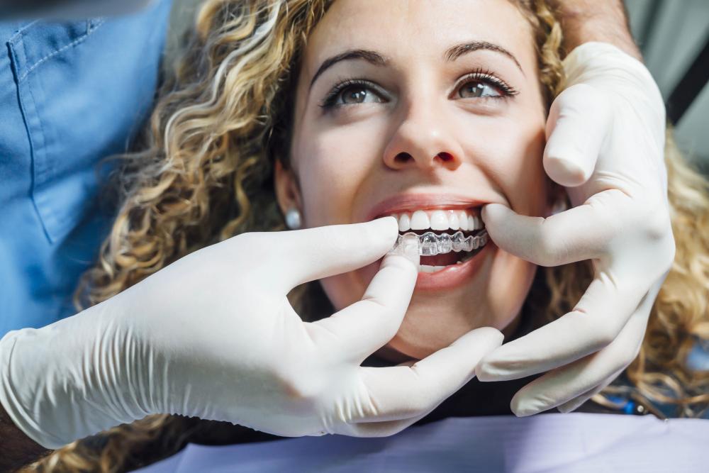 How Does Invisalign Work Things To Expect During Treatment