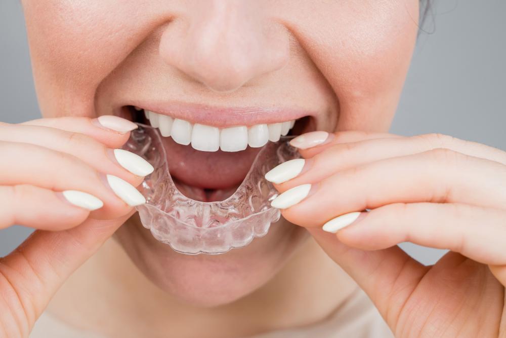 How Much Invisalign Cost In New Jersey What To Expect