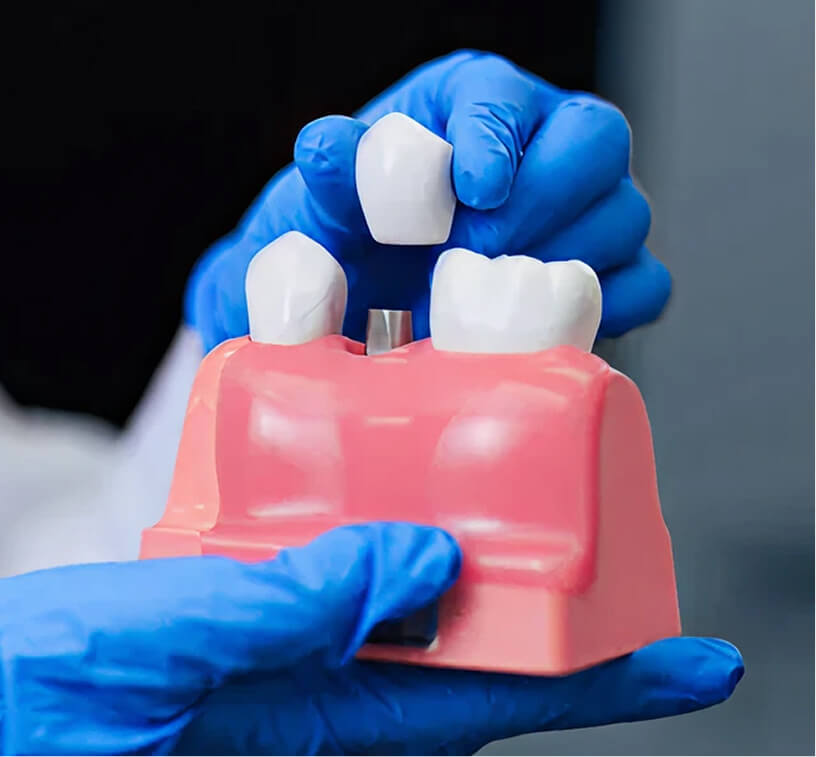 Major-Restorative-Dentist-Image-Dental-Implants