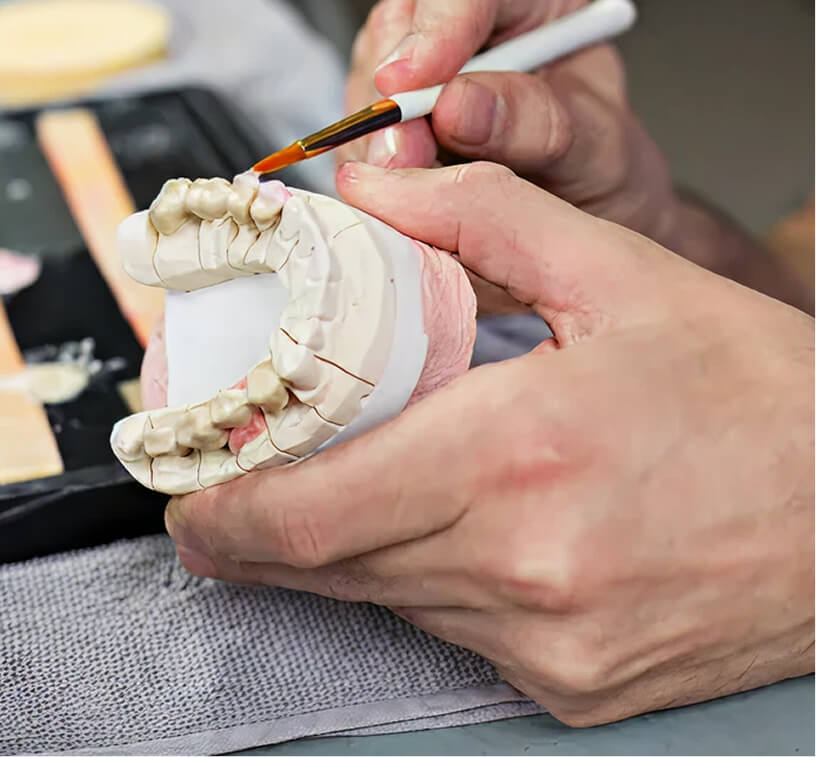 Minor-Restorative-Dental-Image-Inlays-and-Onlays