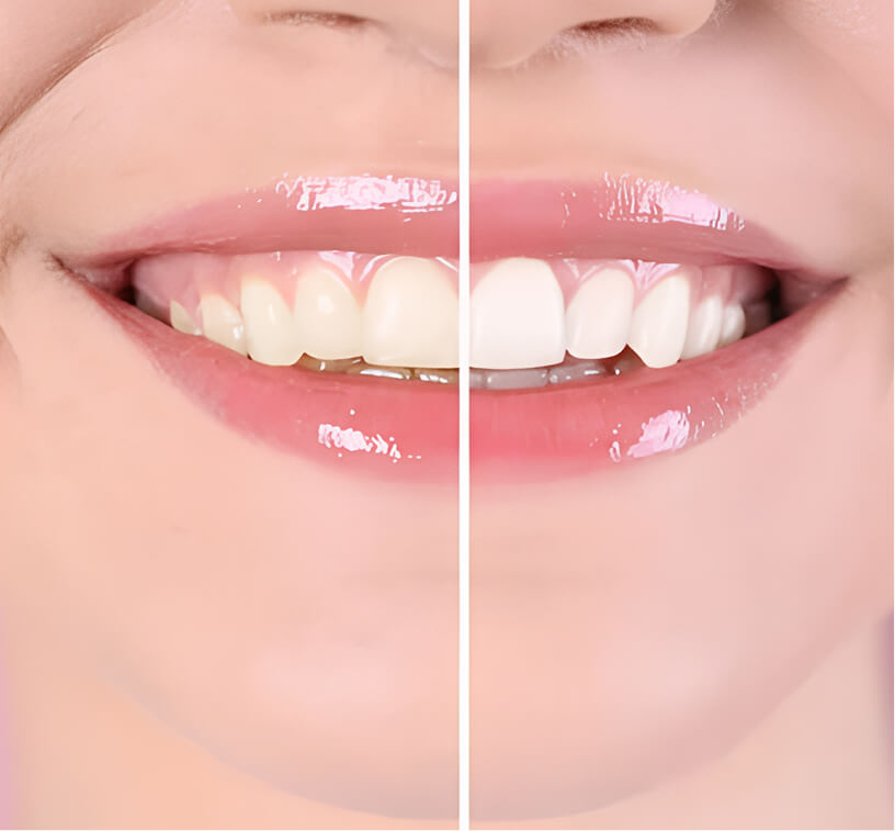 Minor-Restorative-Dental-Image-Tooth-Contouring