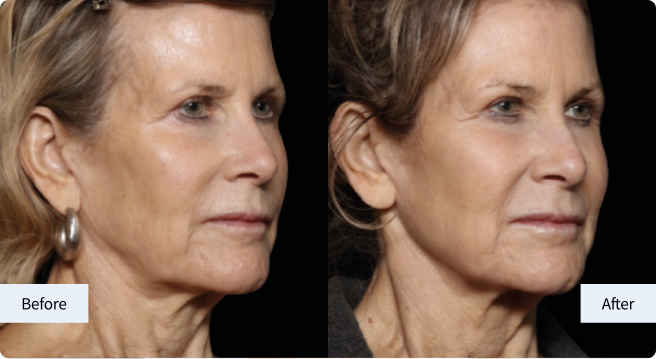 Why Your Face Changes Over Time