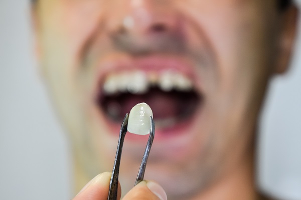 First Steps To Deal With A Chipped Tooth
