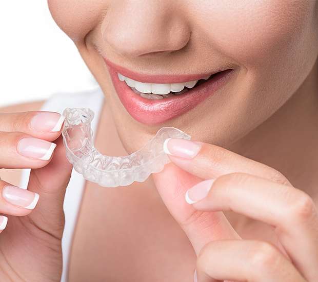 Parlin Clear Aligners