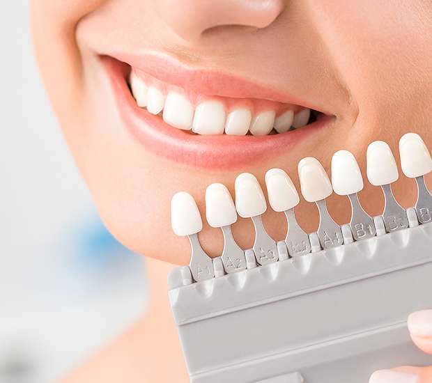 Parlin Dental Veneers and Dental Laminates
