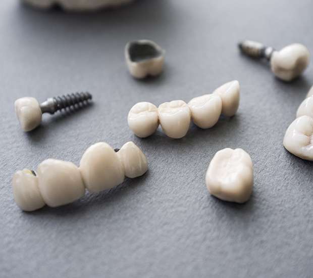 Parlin The Difference Between Dental Implants and Mini Dental Implants