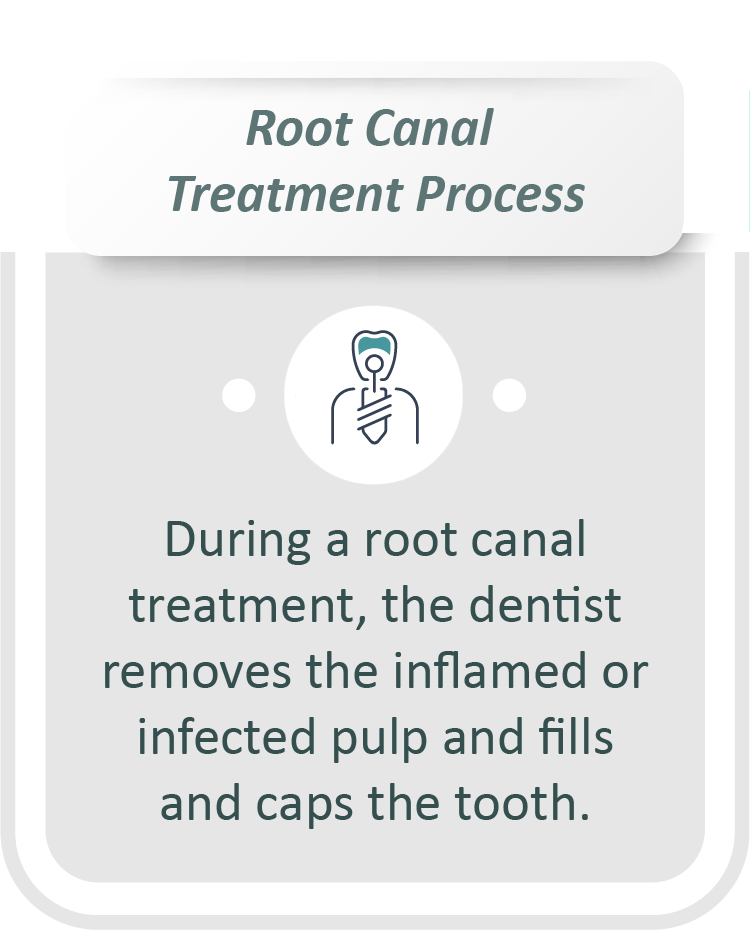 Root canal treatment infographic: During a root canal treatment, the dentist removes the inflamed or infected pulp and fills and caps the tooth.